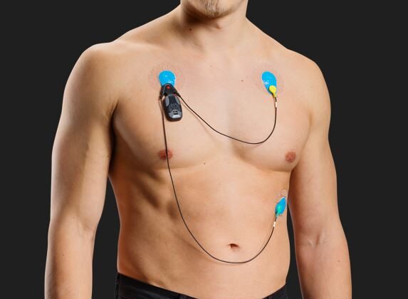 Holter Monitoring