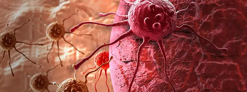 Cancer Surgeries Are Different