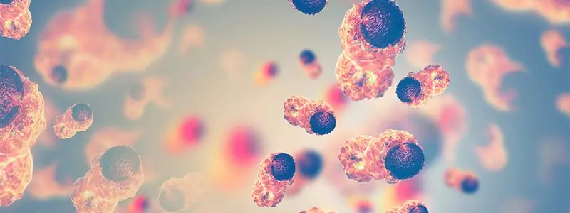 Diagnosing Cancer Isn’t Always Simple