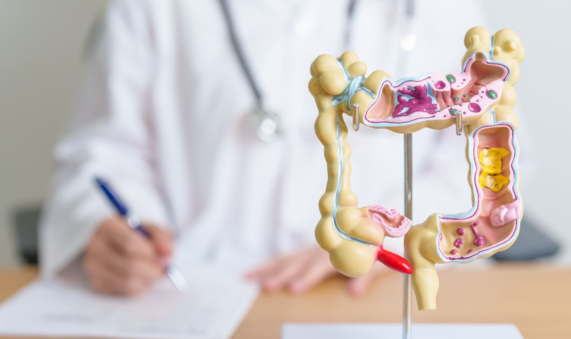 Understanding Colorectal Health