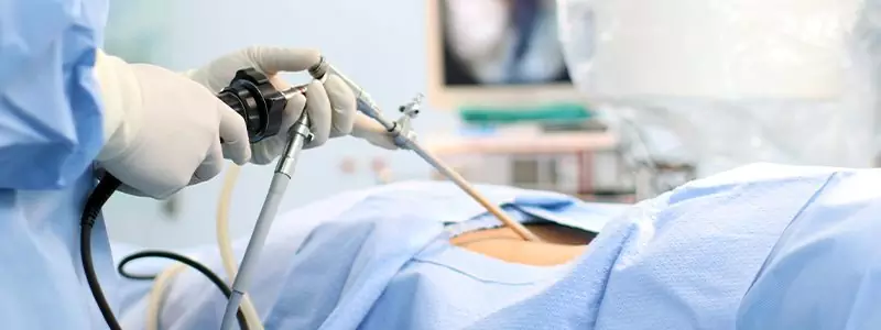 The Day of Surgery: What to Expect
