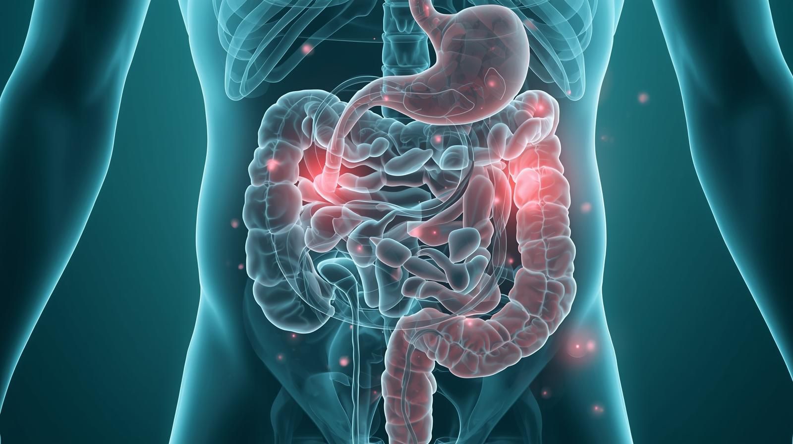 Stomach Cancer vs. Colon Cancer: Key Differences Patients Should Know